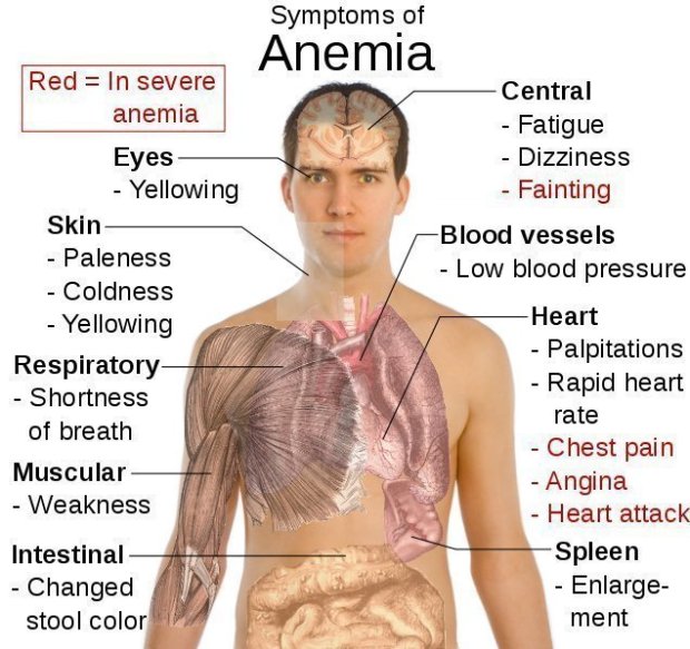 symptoms-of-anemia